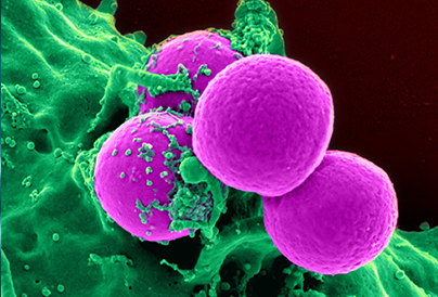 Immunity and tumor: revealing the origin of tumor