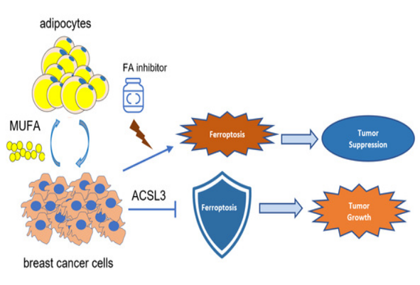 Fat has become the accomplice of breast cancer! Fudan tumor team discovered for the first time